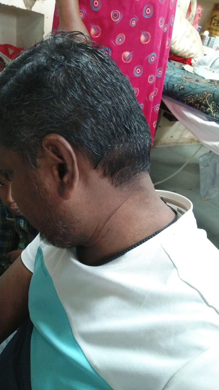 चाइना मांजे से बढ़ रही है घटनाएं, आम नागरिकों की जान पर बन आई