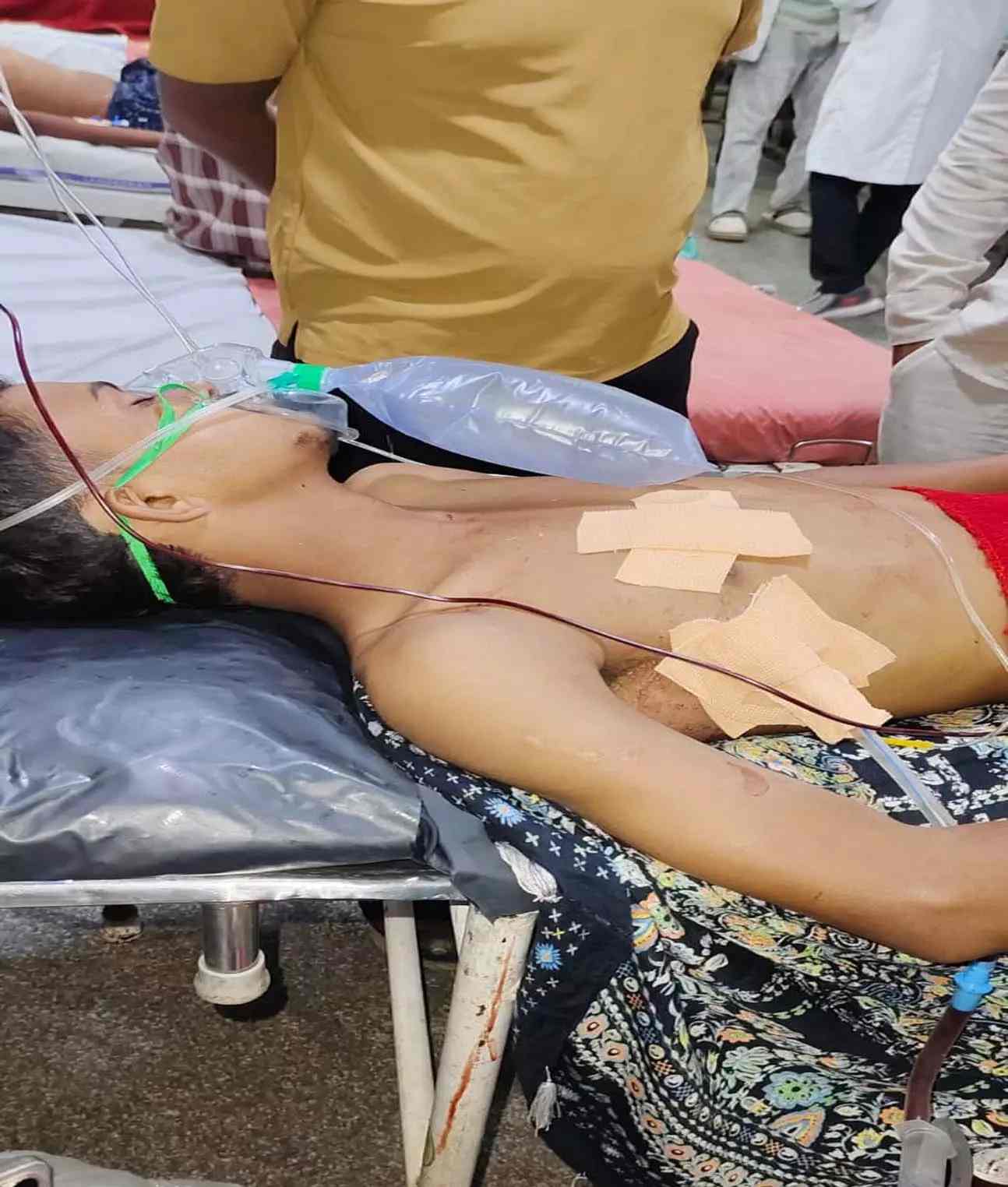 राजधानी में दिनदहाड़े खूनी खेल: बीच सड़क पर युवक के सीने में घोंपा चाकू, पुरानी रंजिश में जानलेवा हमला कर आरोपी फरार!
